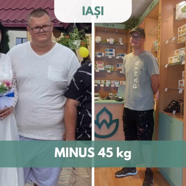 before and after barbat 2