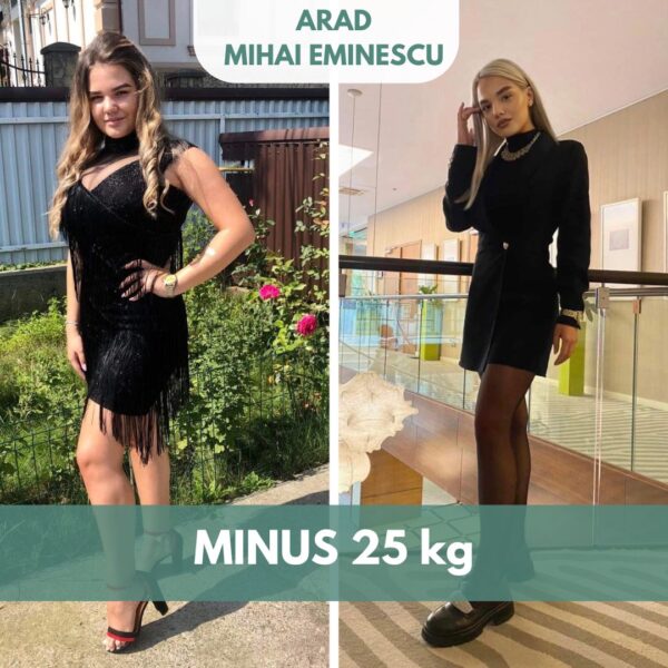 before and after fata